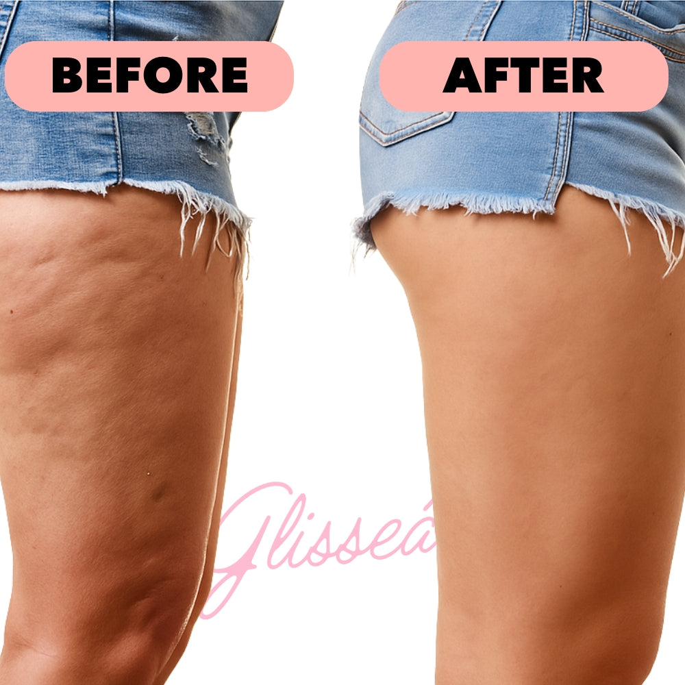 Glisseá Cellulite Relief Sculptor™